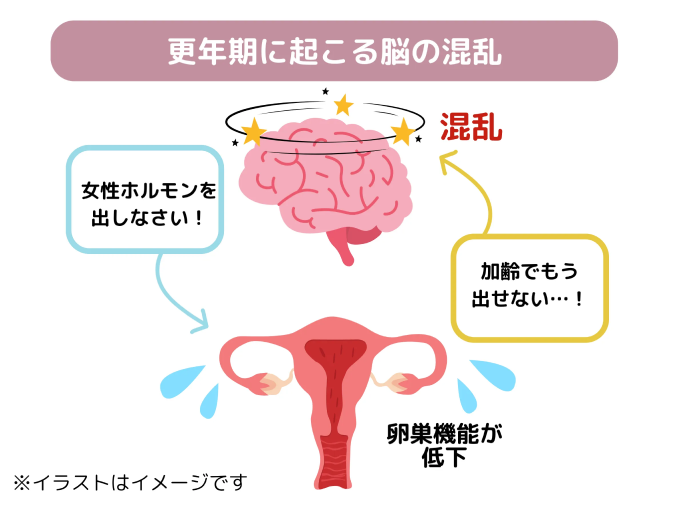 更年期に起こる脳の混乱のイラスト