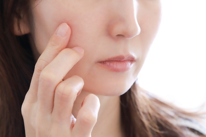 肌悩みを抱える女性の顔
