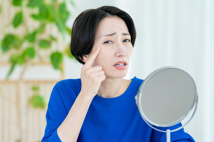 肌悩みを抱える女性の画像