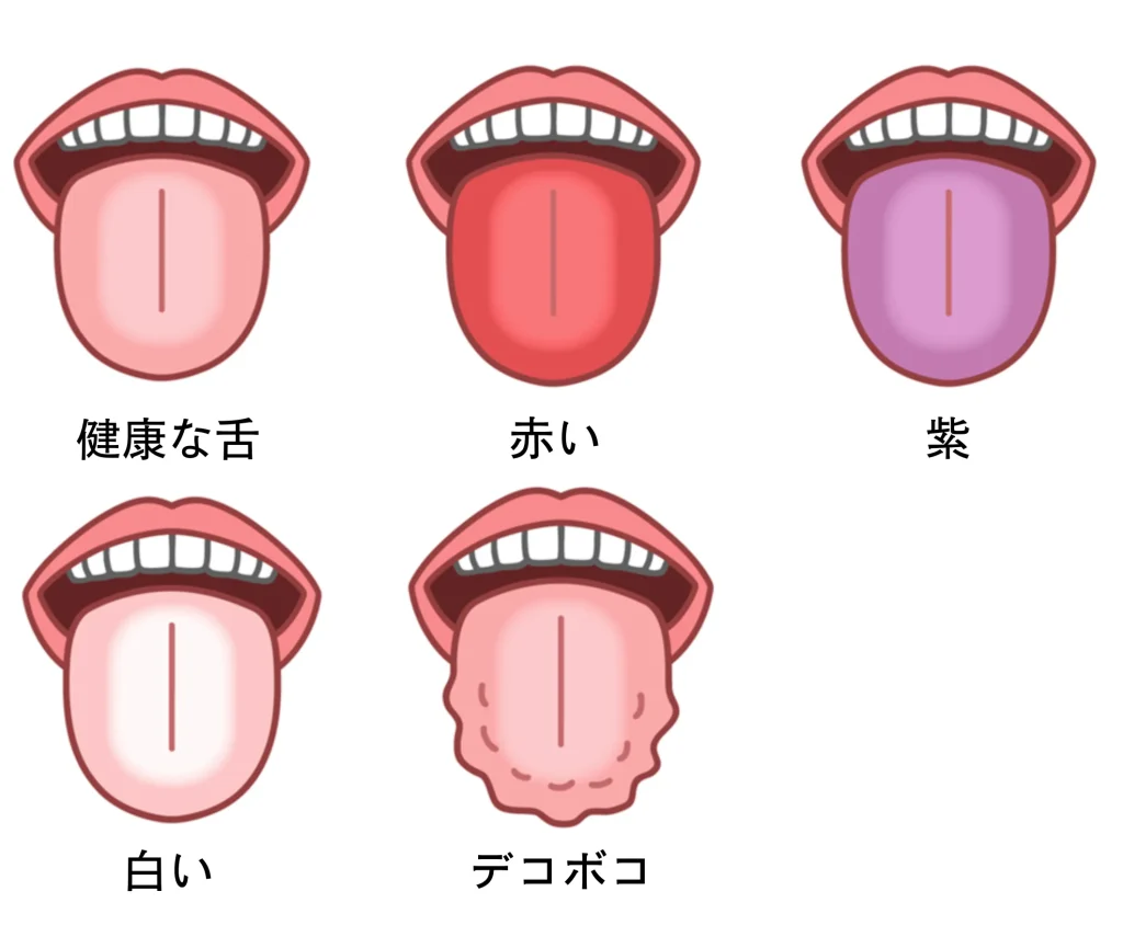 舌の状態のイラスト